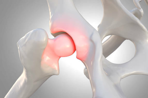 Bone Health Nutrition
